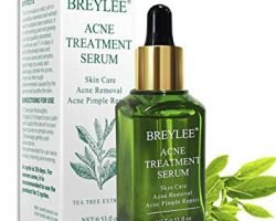 Free Acne Treatment Serum Product (Breylee)